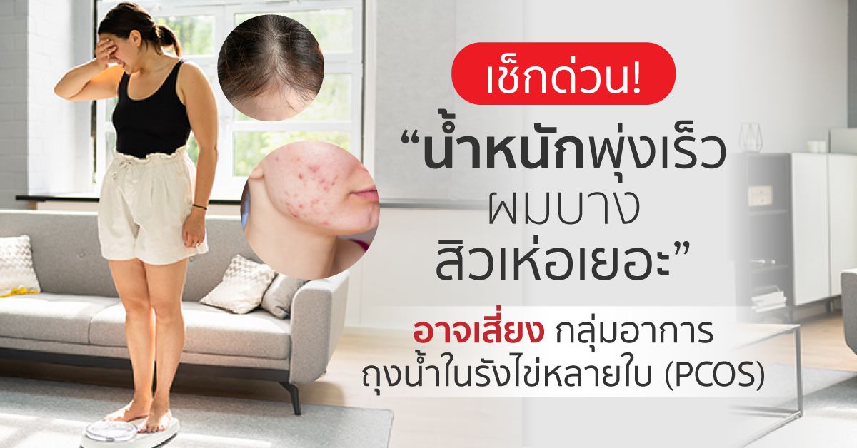 Images/Blog/Q8WFfPAg-เช็คด่วน! น้ำหนักพุ่งเร็ว ผมบาง สิวเห่อเยอะ อาจเสี่ยง -กลุ่มอาการถุงน้ำในรังไข่หลายใบ (PCOS).png